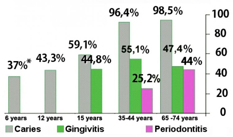 Dental caries the most common infectious disease worldwide